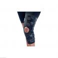 DONJOY OA GO Knieorth.li.medial/re.lateral XL