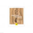 GU Hallux valgus
