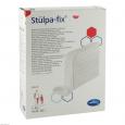 STÜLPA Fix Gr.4 Bein/Fuß/Kdr.Rumpf 25 m Netzschl.