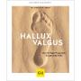GU Hallux valgus