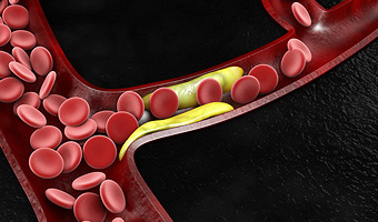 Cholesterin - Helfer oder Störfaktor?